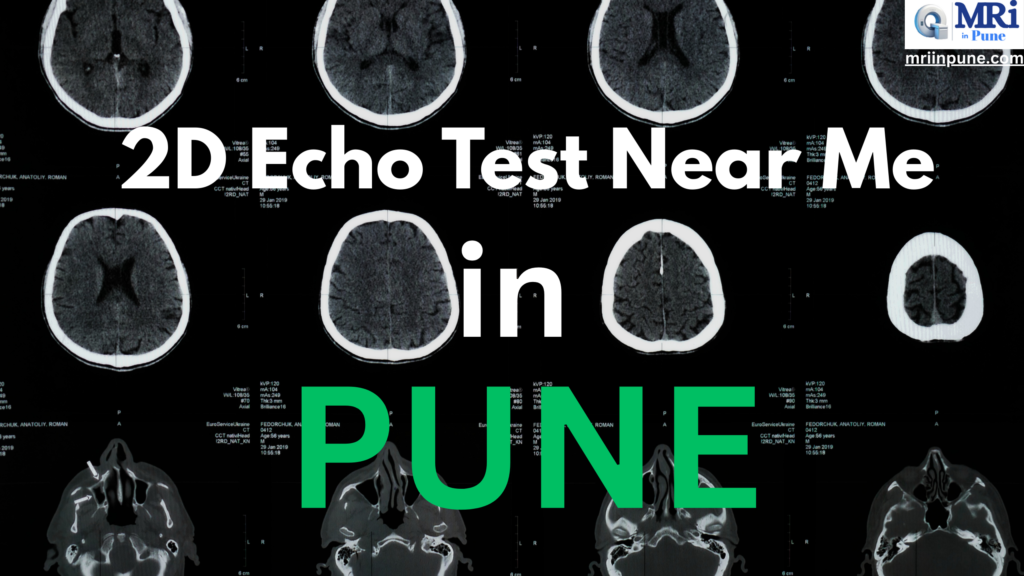 2D echo test near me